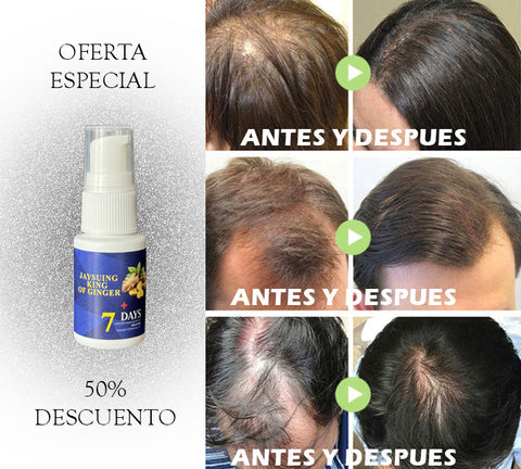 Liquid Crece Cabello para Hombre y Mujer